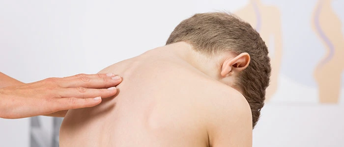 scoliosis treatment